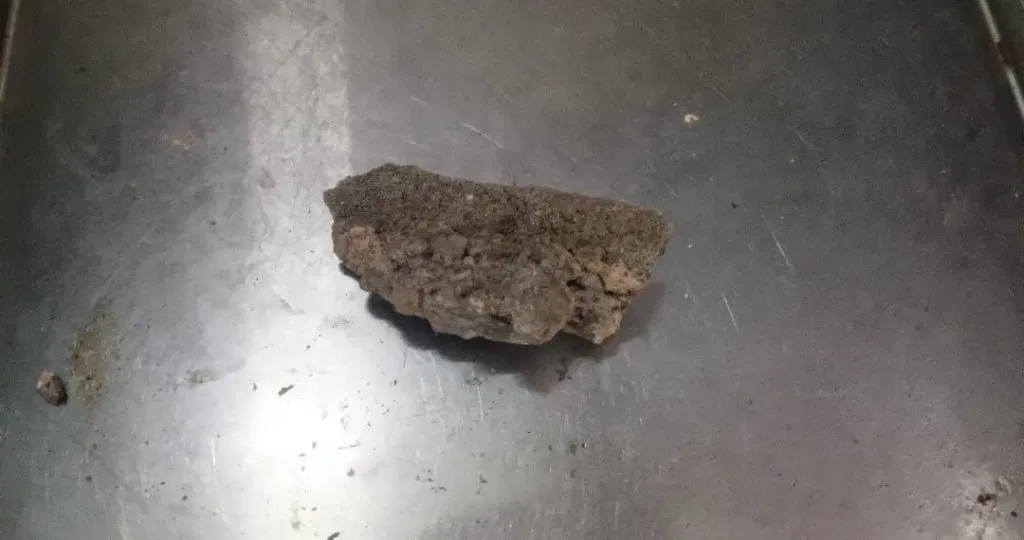 Khairagarh hospital accident